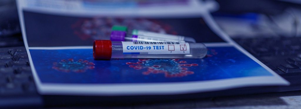 Covid 19 Coronavirus Test Avellino Provincia
